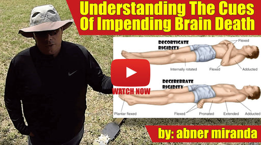 Understanding the Cues of Impending Brain Death